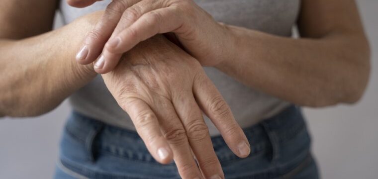 Rheumatoid Arthritis