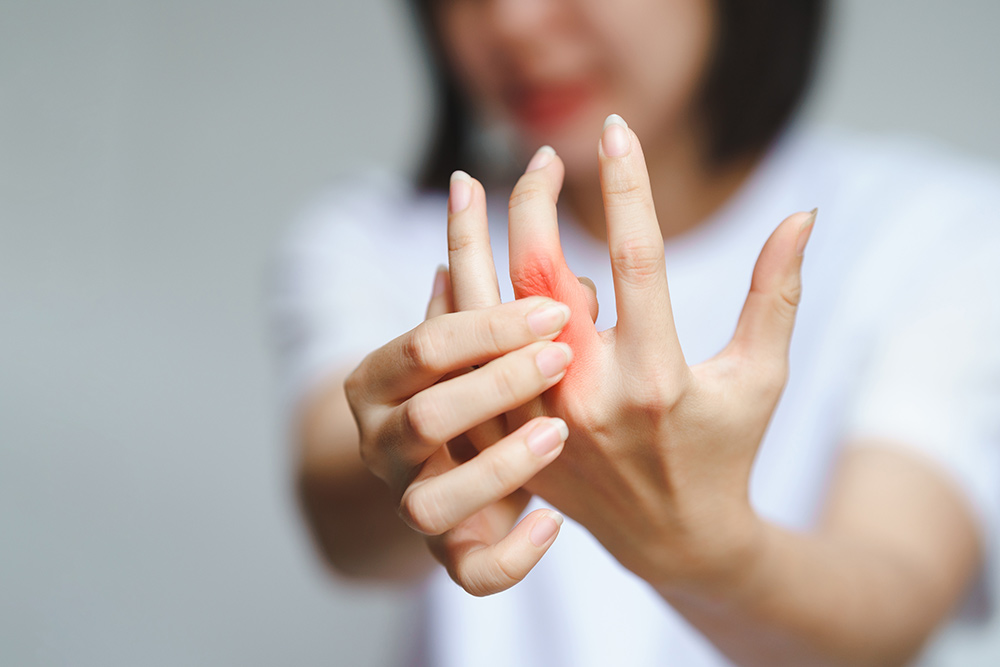 the 4 stages of rheumatoid arthritis