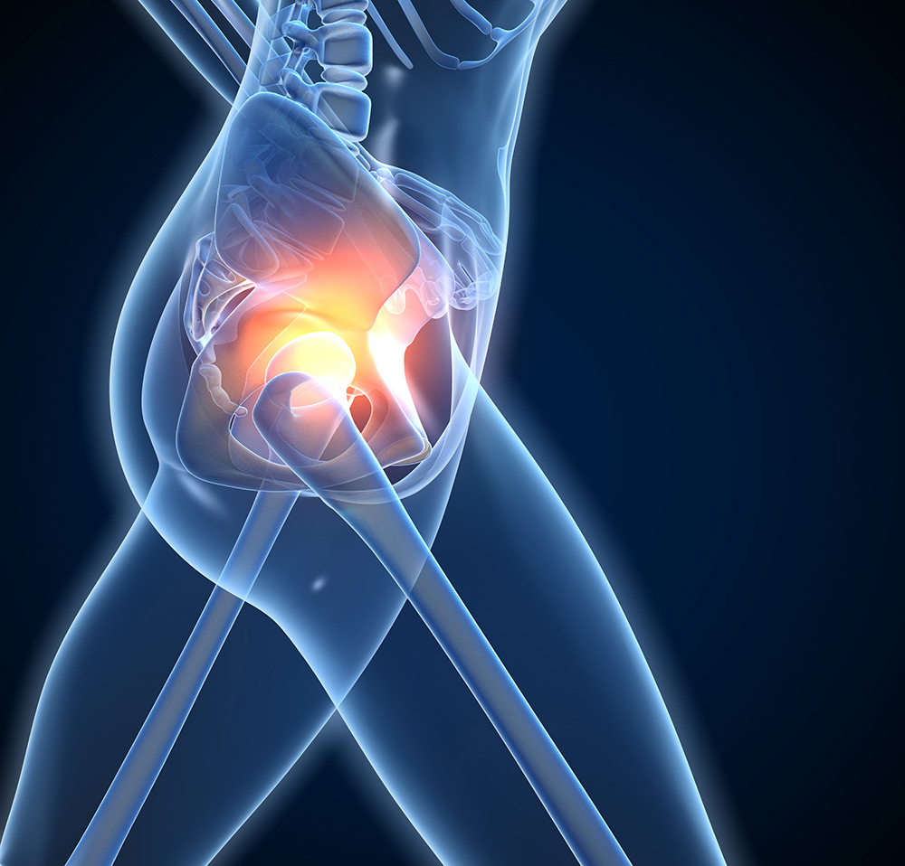 Does Stress Cause Arthritis | Arthritis Pain | Clinic in Brisbane