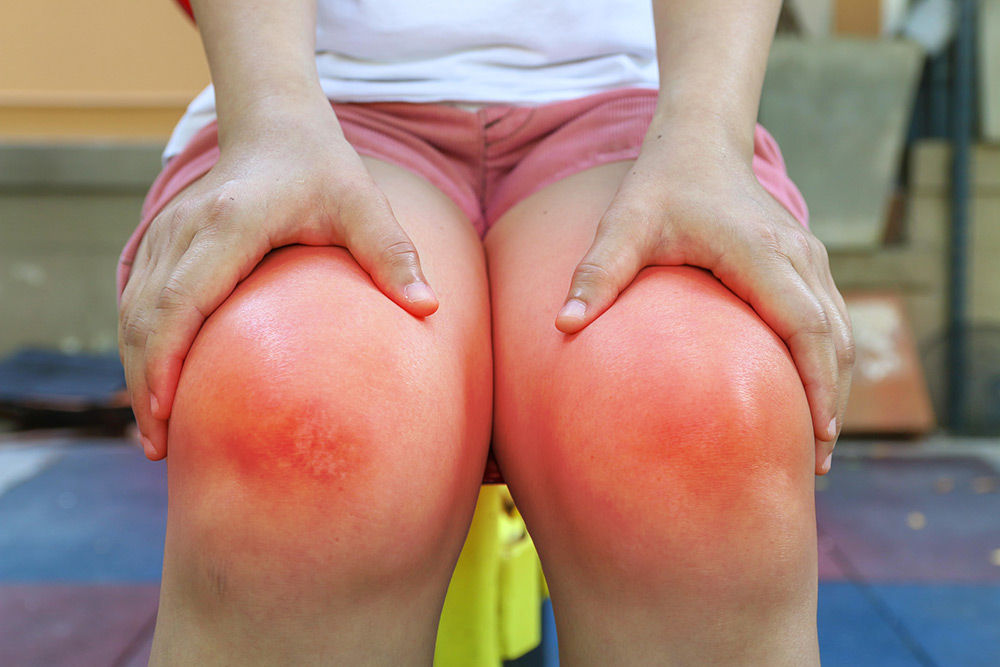 Rheumatologist in Brisbane | Smoking and rheumatoid arthritis | Quit Smoking 